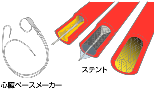 治療機器